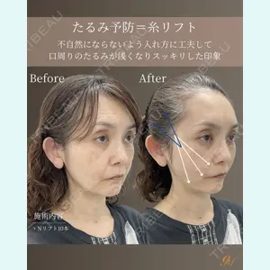 gift clinic 能登谷 翔医師の症例