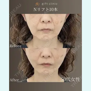 gift clinic 能登谷 翔医師の症例