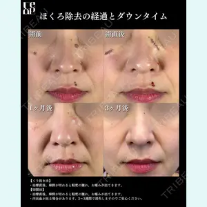 症例