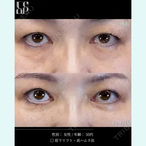 症例