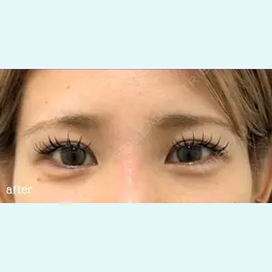神戸スイミー皮膚科美容外科の症例