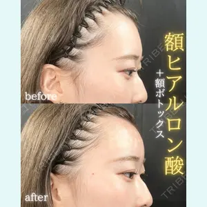 症例