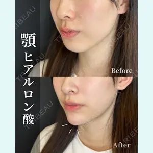 症例