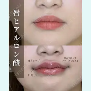 症例