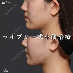 症例