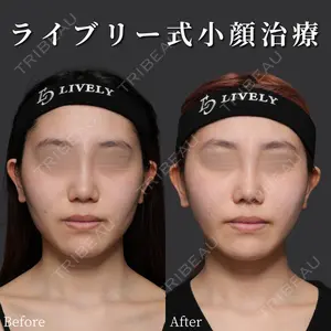 症例