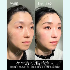 HAAB×DREAM BEAUTY CLINIC 大阪梅田院 鈴木 馨斗医師の症例