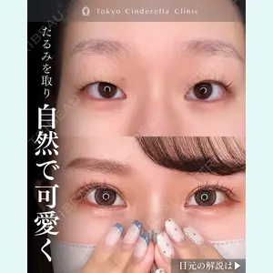 症例