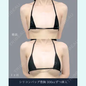 症例