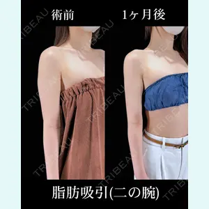 症例