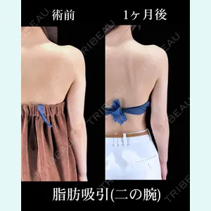 HAAB×DREAM BEAUTY CLINIC 東京本院 吉岡 修一医師の症例