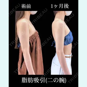 症例