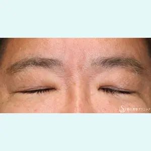 聖心美容クリニック 名古屋院 加藤 大典医師の症例