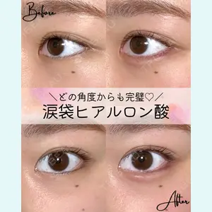 症例