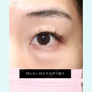 症例