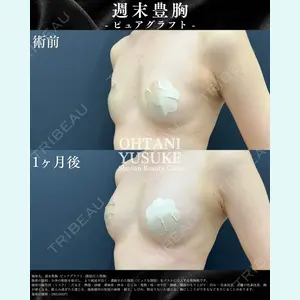 症例