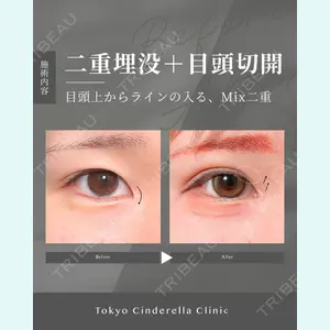 症例