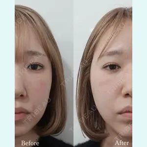 L‘amour clinic Tokyo【ラムールクリニック東京】の症例