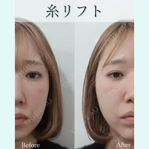L‘amour clinic Tokyo【ラムールクリニック東京】の症例