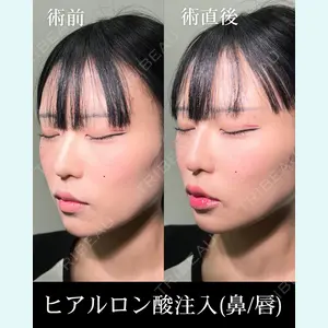 HAAB×DREAM BEAUTY CLINIC 大阪梅田院 柏木 太雅医師の症例