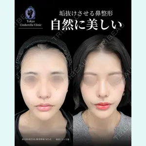 症例