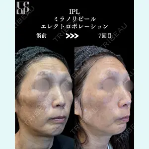 症例