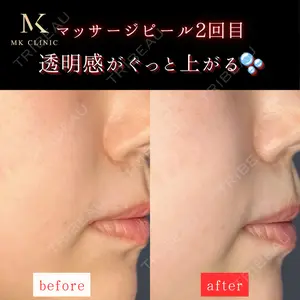 症例