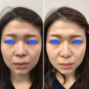 しのぶ皮膚科 蘇原しのぶ医師の症例