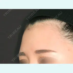 MAe Clinic 東京院 前田 翔医師の症例