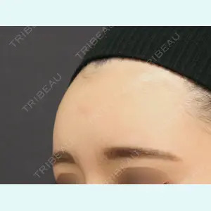MAe Clinic 東京院 前田 翔医師の症例