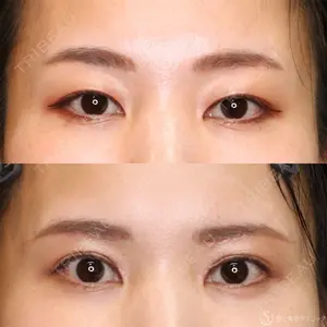 聖心美容クリニック 名古屋院 加藤 大典医師の症例