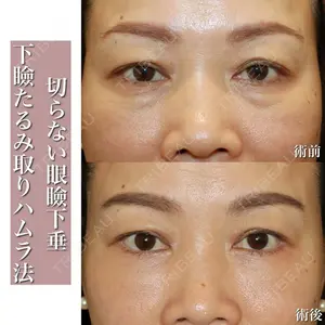 大塚美容形成外科 金沢院の症例