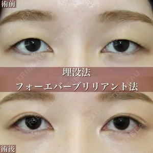大塚美容形成外科 札幌院の症例