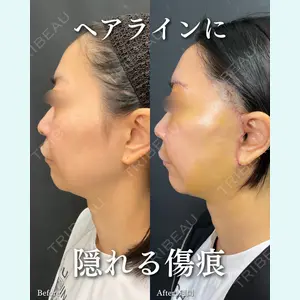 症例