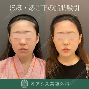 オアシス美容外科 遠藤 剛史医師の症例