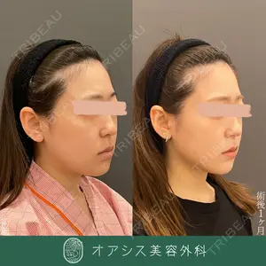 オアシス美容外科 遠藤 剛史医師の症例