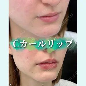症例