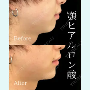 ルラ美容クリニック 池袋院 日名地 あゆみ医師の症例