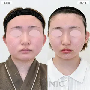 A CLINIC（エークリニック） 横浜院 柴田 貴志医師の症例