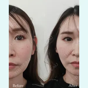 L‘amour clinic Tokyo【ラムールクリニック東京】の症例