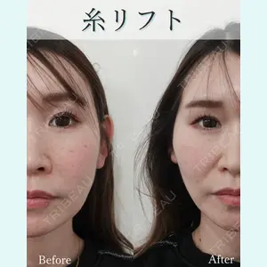 L‘amour clinic Tokyo【ラムールクリニック東京】の症例