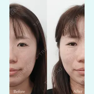 L‘amour clinic Tokyo【ラムールクリニック東京】の症例