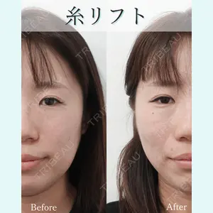 L‘amour clinic Tokyo【ラムールクリニック東京】の症例