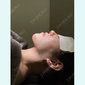 Çà et Là Clinique（さえらクリニック） 山﨑 冴羅医師の症例
