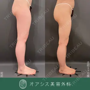 オアシス美容外科 遠藤 剛史医師の症例