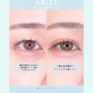 アリエル美容クリニック 横浜院 渡邉 光医師の症例