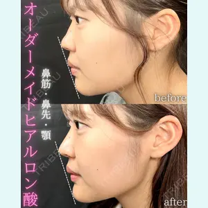 症例