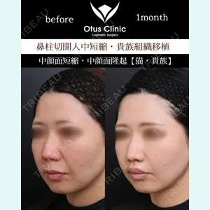 Otus Clinic 【オータスクリニック】 中 徳太郎医師の症例