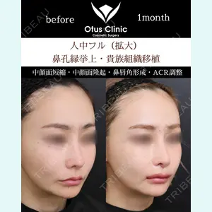 Otus Clinic 【オータスクリニック】 中 徳太郎医師の症例