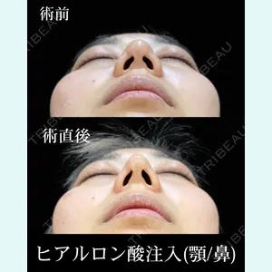 症例